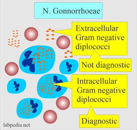 The laboratory diagnosis of Neisseria gonorrhoeae .